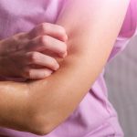 Η βασική φροντίδα της νευροδερματίτιδας