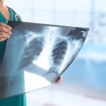 CoViD-19 και καρκίνος πνεύμονα – Σύγκριση έκβασης καρκινοπαθών και μη